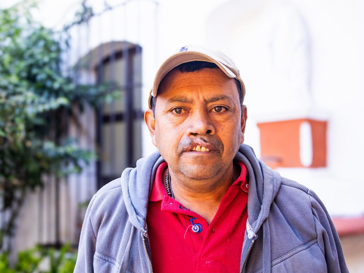 Mario before Surgery